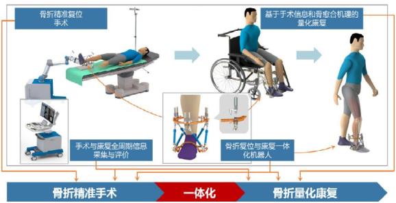 天津大学研发机器人骨折修复技术